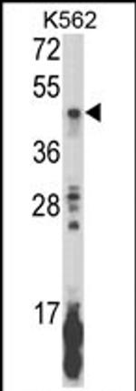 KIR2DL5B Antibody in Western Blot (WB)