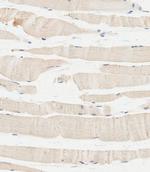 GBA Polyclonal Antibody