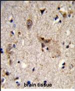 ALDH18A1 Antibody in Immunohistochemistry (IHC)