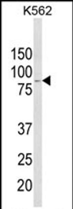 ALDH18A1 Antibody in Western Blot (WB)
