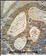 INSIG1 Antibody in Immunohistochemistry (IHC)