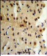 CLIP1 Antibody in Immunohistochemistry (IHC)