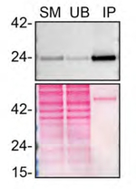 RAB8A Antibody in Western Blot (WB)