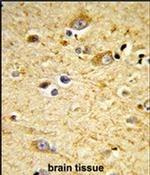 GSTA4 Antibody in Immunohistochemistry (IHC)