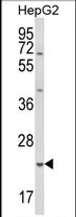 GSTA4 Antibody in Western Blot (WB)