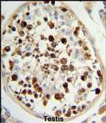 SKA3 Antibody in Immunohistochemistry (IHC)