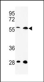 SKA3 Antibody in Western Blot (WB)