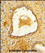 DAB2 Antibody in Immunohistochemistry (IHC)