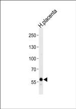 DAB2 Antibody in Western Blot (WB)