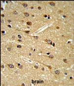 DPP10 Antibody in Immunohistochemistry (IHC)