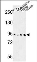 DPP10 Antibody in Western Blot (WB)