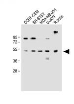 EDIL3 Antibody in Western Blot (WB)