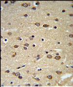 DLK2 Antibody in Immunohistochemistry (IHC)