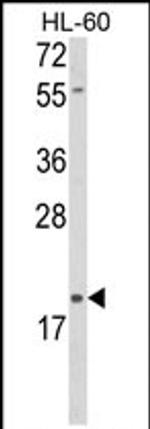 DLK2 Antibody in Western Blot (WB)