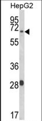 WAC Antibody in Western Blot (WB)