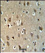 UPK1B Antibody in Immunohistochemistry (IHC)