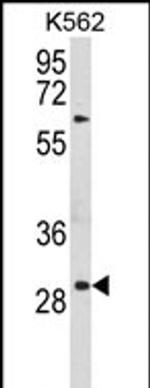 UPK1B Antibody in Western Blot (WB)