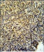 WASP Polyclonal Antibody