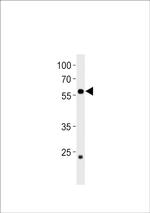 CCDC149B Polyclonal Antibody