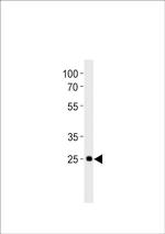 DLX6A Antibody in Western Blot (WB)