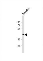 HOXA1A Antibody in Western Blot (WB)