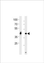 HOXA1A Polyclonal Antibody
