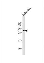 HOXB8B Polyclonal Antibody