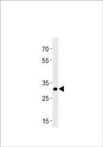 HOXB8B Antibody in Western Blot (WB)