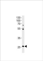 HOXC4A Polyclonal Antibody
