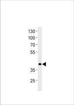 HOXD11A Antibody in Western Blot (WB)