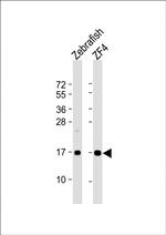 NDUFAF3 Polyclonal Antibody