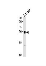 Neurogenin 1 Polyclonal Antibody