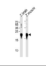 DJ-1 Polyclonal Antibody