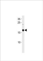 SELM Antibody in Western Blot (WB)