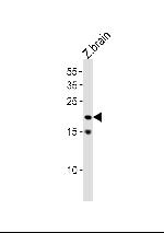 TCF21 Polyclonal Antibody