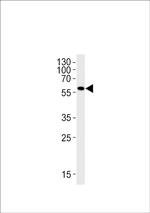 MAO Polyclonal Antibody