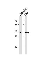 GNB1 Polyclonal Antibody