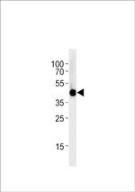 IRF2BP2A Polyclonal Antibody