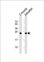 DUSP22A Polyclonal Antibody