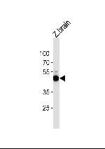 ATG4B Antibody in Western Blot (WB)