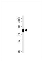 CHST11 Antibody in Western Blot (WB)