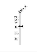 HNF1BB Polyclonal Antibody