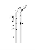 Adenosine Deaminase Polyclonal Antibody
