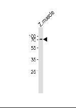 ZNF143 Polyclonal Antibody