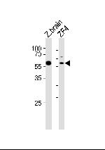 PAPL Polyclonal Antibody
