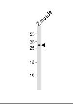 HOXB6A Polyclonal Antibody