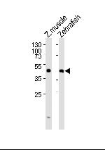 DIXDC1A Polyclonal Antibody