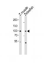 ZNF148 Polyclonal Antibody