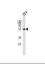 ANKRD13C Polyclonal Antibody