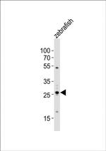 BHLHA9 Antibody in Western Blot (WB)